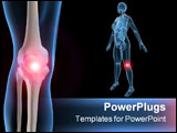 PowerPoint Template - 3d rendered anatomy illustration of a human knee with pain