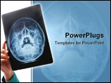 PowerPoint Template - Hand holding xray image of skull area. PS: film grain is visible on the xray negative film